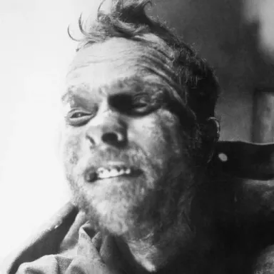 Foto de perfil de Albert Johnson (criminal)