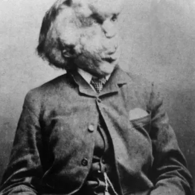 Joseph Merrick profile photo
